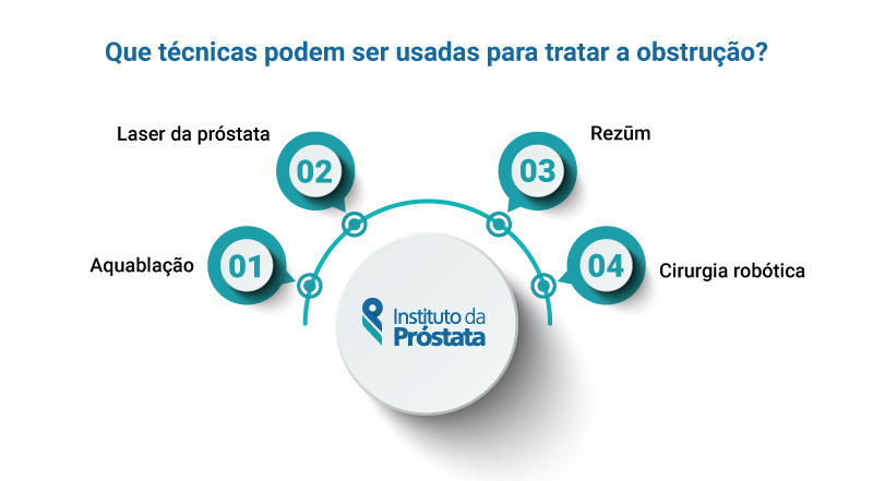 Infografico Tecnicas Hiperplasia Benigna Da Prostata Sintomas Instituto Da Prostata