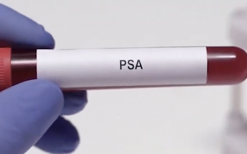 Psa Cancro Da Prostata Sintomas Factores De Risco E Avaliacao Explicados Por Um Urologista Instituto Da Prostata